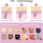 IPL Hair Removal